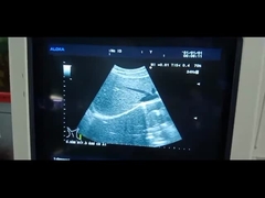 Aloka UST-9130 مسبار الموجات فوق الصوتية مجموعة محدبة UST-9130 محول طاقة الموجات فوق الصوتية