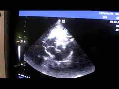 Mindray 2P2 مصفوفة تدريجية لمجس محول طاقة الموجات فوق الصوتية للقلب / طب الأطفال